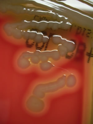 Bacteriekolonies op voedingsbodem