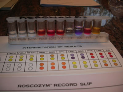Biochemische test voor bepalen bacteriesoort