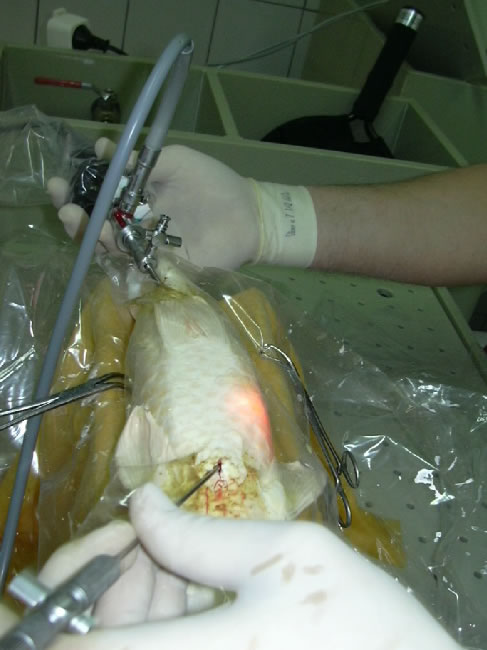 Endoscopie