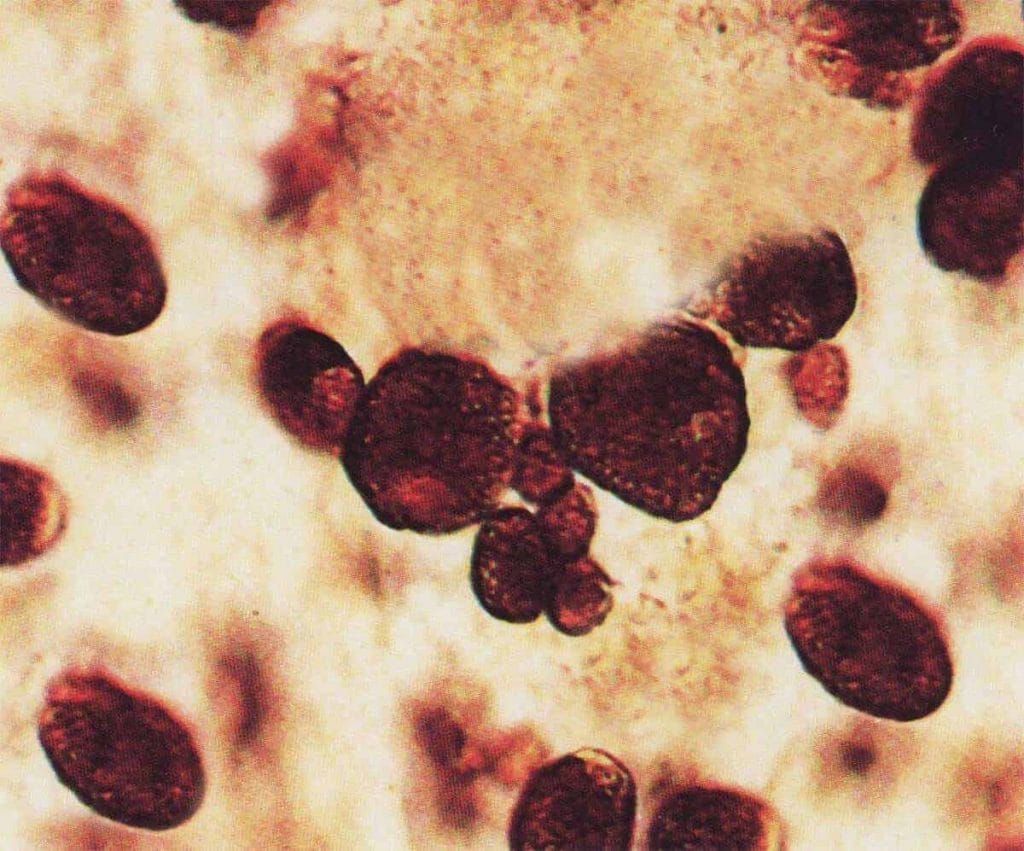 Costia, Ichthyobodo necator The Pond Library